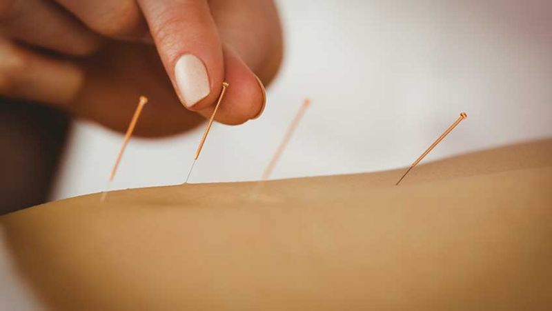 Benefits of Acupuncture in the Workplace