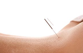 About acupuncture