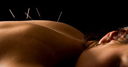 Cosmetic Acupuncture