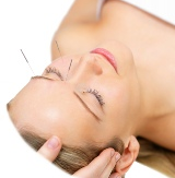 Facial Enhancement Cosmetic Acupuncture
