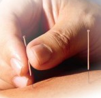 How Acupuncture works?