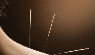 Acupuncture and Pain
