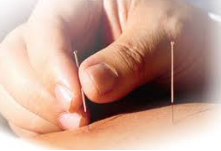 What is Acupuncture?