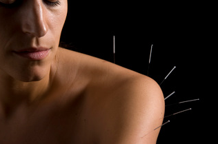 Affordable Pain Relief Acupuncture