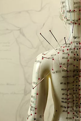 Acupuncture