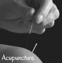 Traditional Chinese Acupuncture