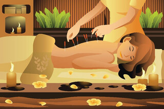 Acupuncture