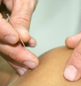 Acupuncture and Herbs