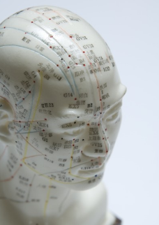 What is acupuncture?