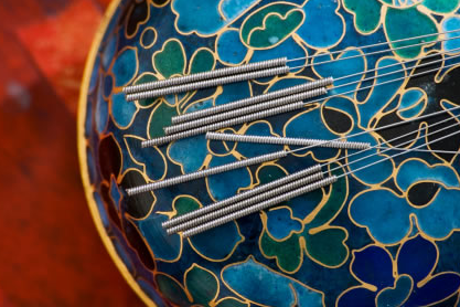 What is Acupuncture? 0 What is Acupuncture?