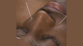 Sheffield 1 Acupuncture