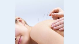 Acupuncture Therapy Coventry