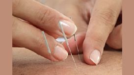 Acupuncture For Health & Wellbeing