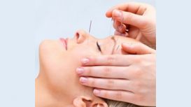 Chingford Acupuncture