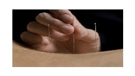 Janice Thompson Acupuncture