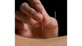 Sharon Darby Acupuncture