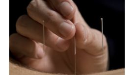 Harry Sweetman - Acupuncturist